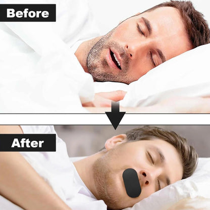 Hypoallergenic Closed Mouth Sleep Tape With Breathing Slot For Adults (30 Pcs)