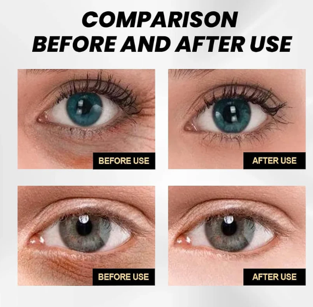 18051 Celyn Instant Firm Eye cream in a 30 ml pack, revitalizes and tightens skin around the eyes, face moisturizer and eye revitalizer.