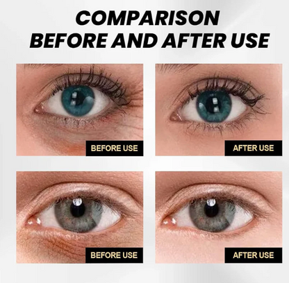 18051 Celyn Instant Firm Eye cream in a 30 ml pack, revitalizes and tightens skin around the eyes, face moisturizer and eye revitalizer.