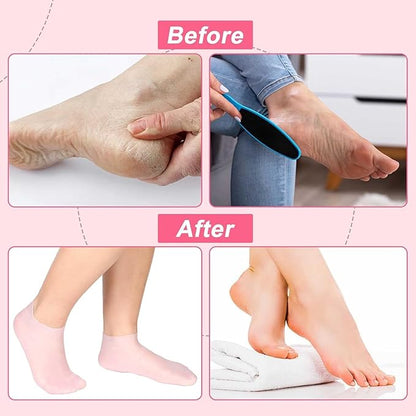Multicoloured Natural Oil Spa Gel Socks (Pack of 2)