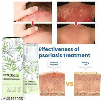 9242 Eczemaron antifungal cream for ringworm, eczema, and fungal infections, shown in a pack of two tubes.