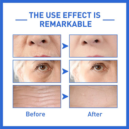 Drpshippr Botox Face Serum and Solution Facial Serum with instant face lift effects, skincare for a youthful, smooth complexion.