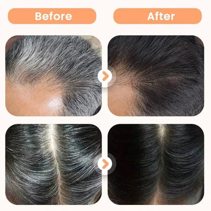Plant Extract Hair Dye for Gray Hair 200 ml (Pack of 2)
