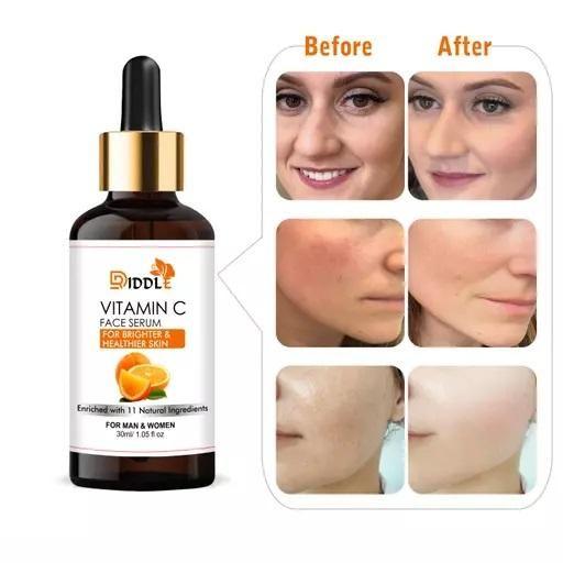 Three bottles of Driddle Professional Vitamin C Face Serum by Drpshippr, showing clear glass bottles with dropper caps for skincare.