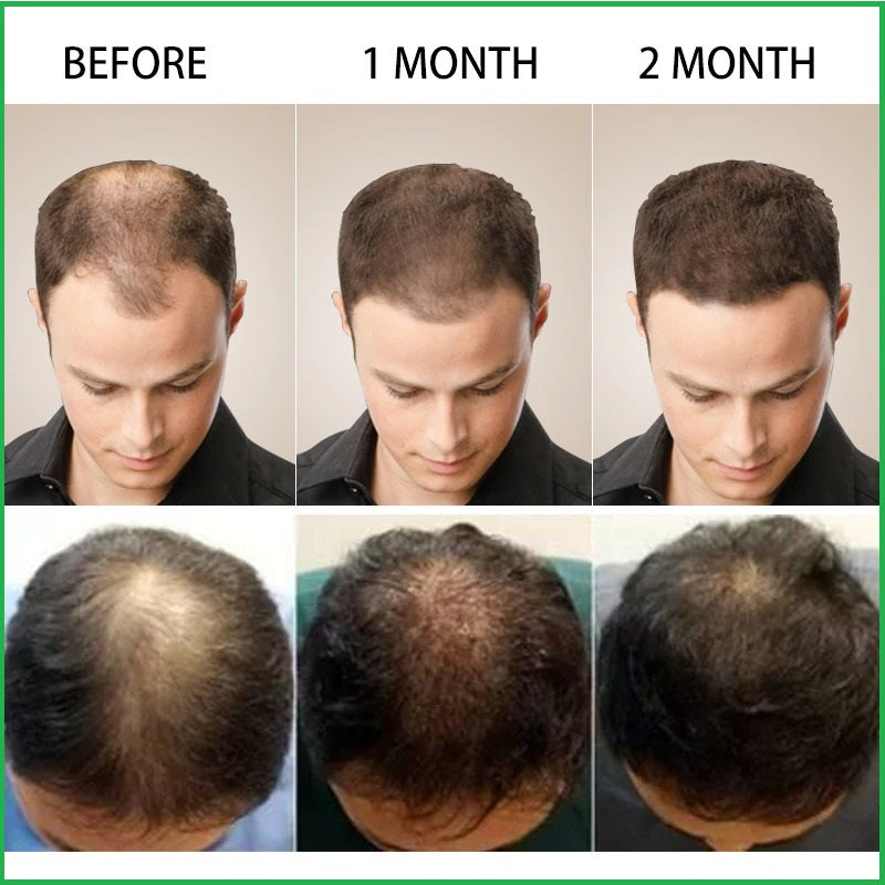Drpshippr Hair Growth Spray for thinning hair, 30ml, unisex treatment to promote fast hair growth and reduce hair loss.