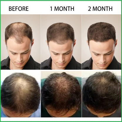 Drpshippr Hair Growth Spray for thinning hair, 30ml, unisex treatment to promote fast hair growth and reduce hair loss.
