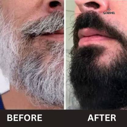 Natural Anti Grey Beard Serum Oil ( Pack Of 2 )