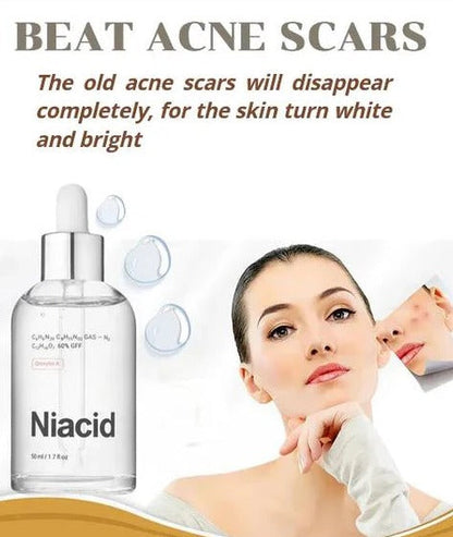 Niacid Face Serum for Pitted Scars & Dark Acne ( Pack Of 1 )