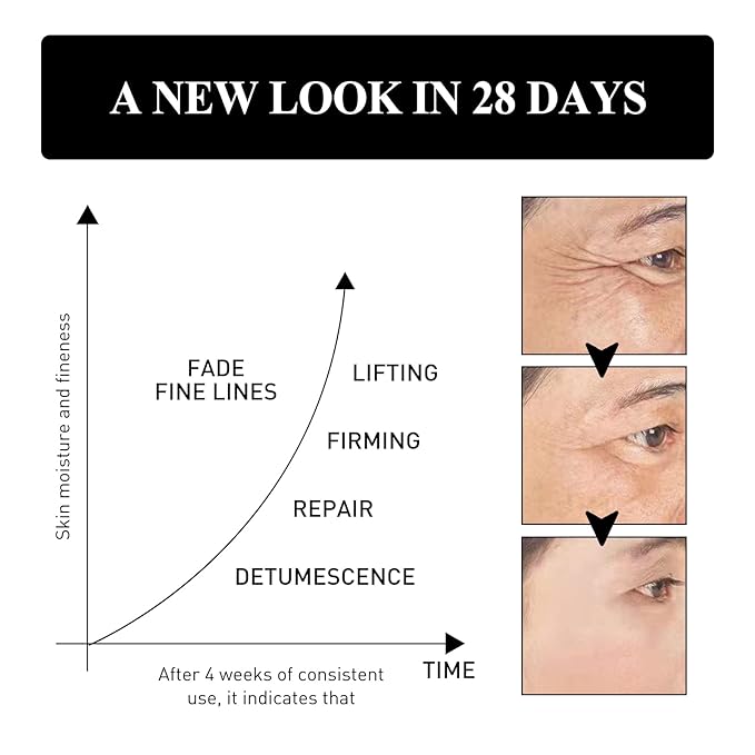 Verfons Firming Eye Cream,Verfons Snake Venom Firming Eye Cream, Verfons Temporary Firming Eye Cream for Bags, Anti Aging Eye Bag Cream, Instant Remove Eye Bags Fades Fine Lines and Wrinkles