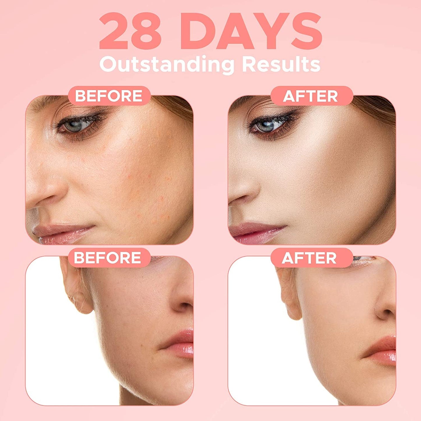 Vitamin C Serum Anti-Aging Anti-Wrinkle Face Serum 30 ml(Pack Of 2)